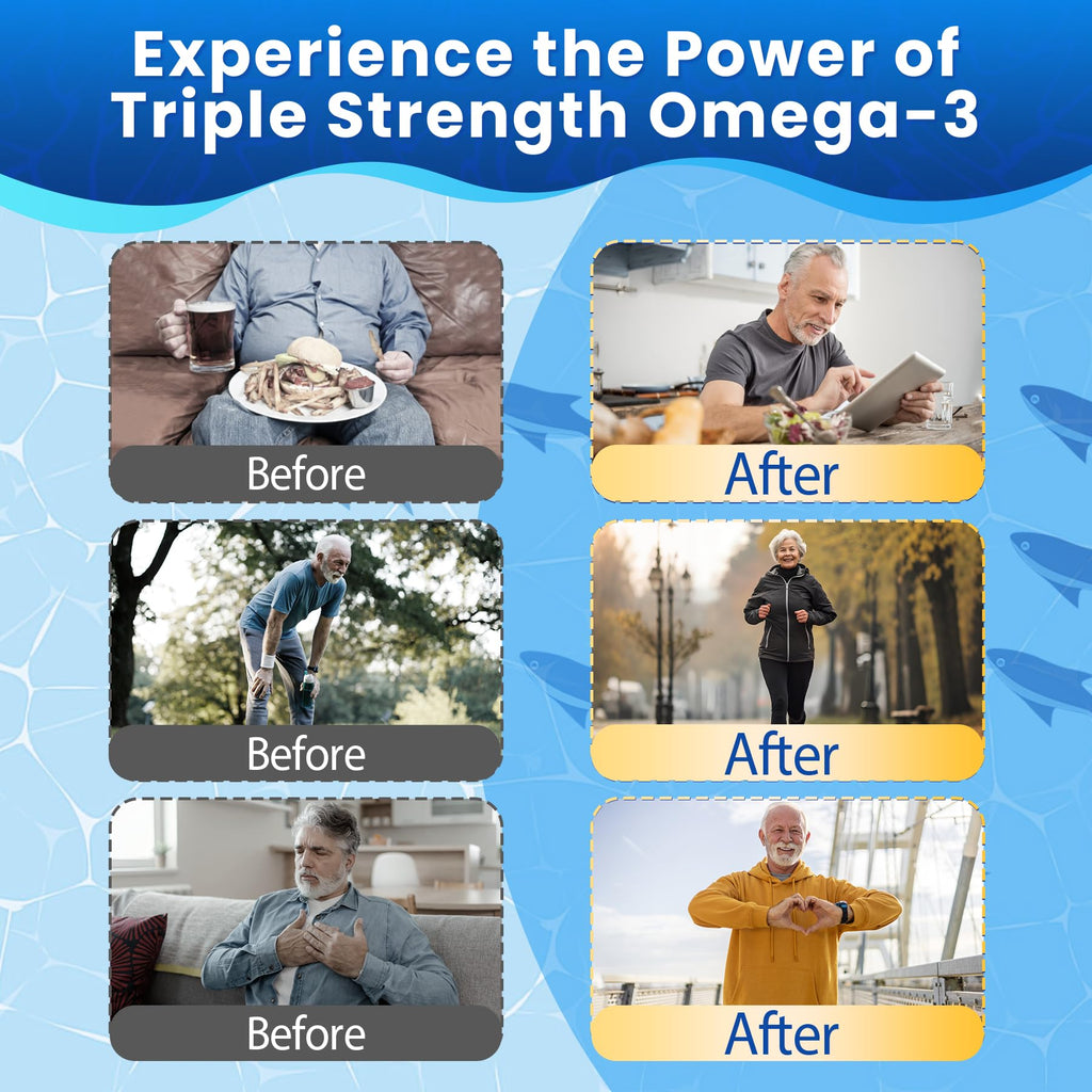Omega-3 Fish Oil Gummies Triple-Strength EPA & DHA

