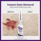 FOLEX Carpet Cleaner Spray - Instant Stain Removal


