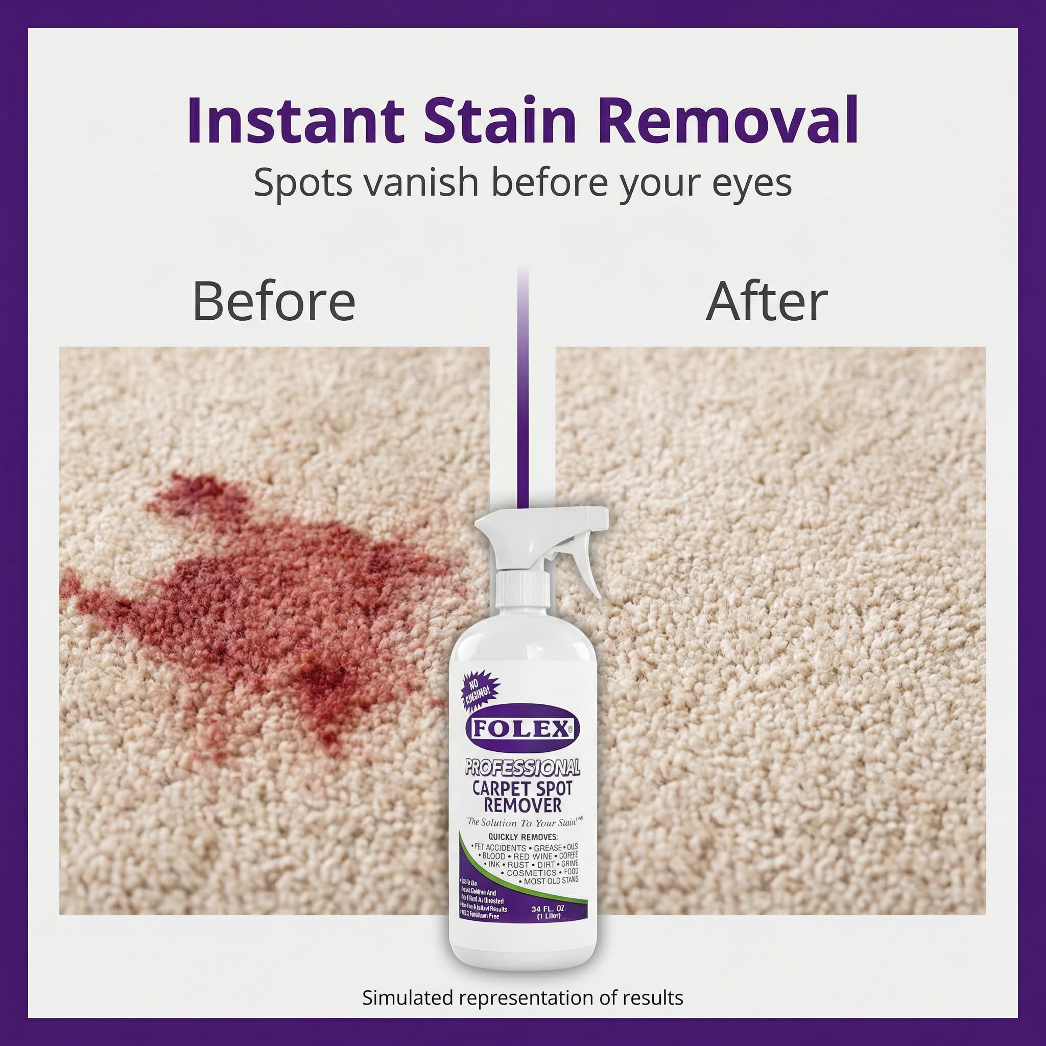 FOLEX Carpet Cleaner Spray - Instant Stain Removal

