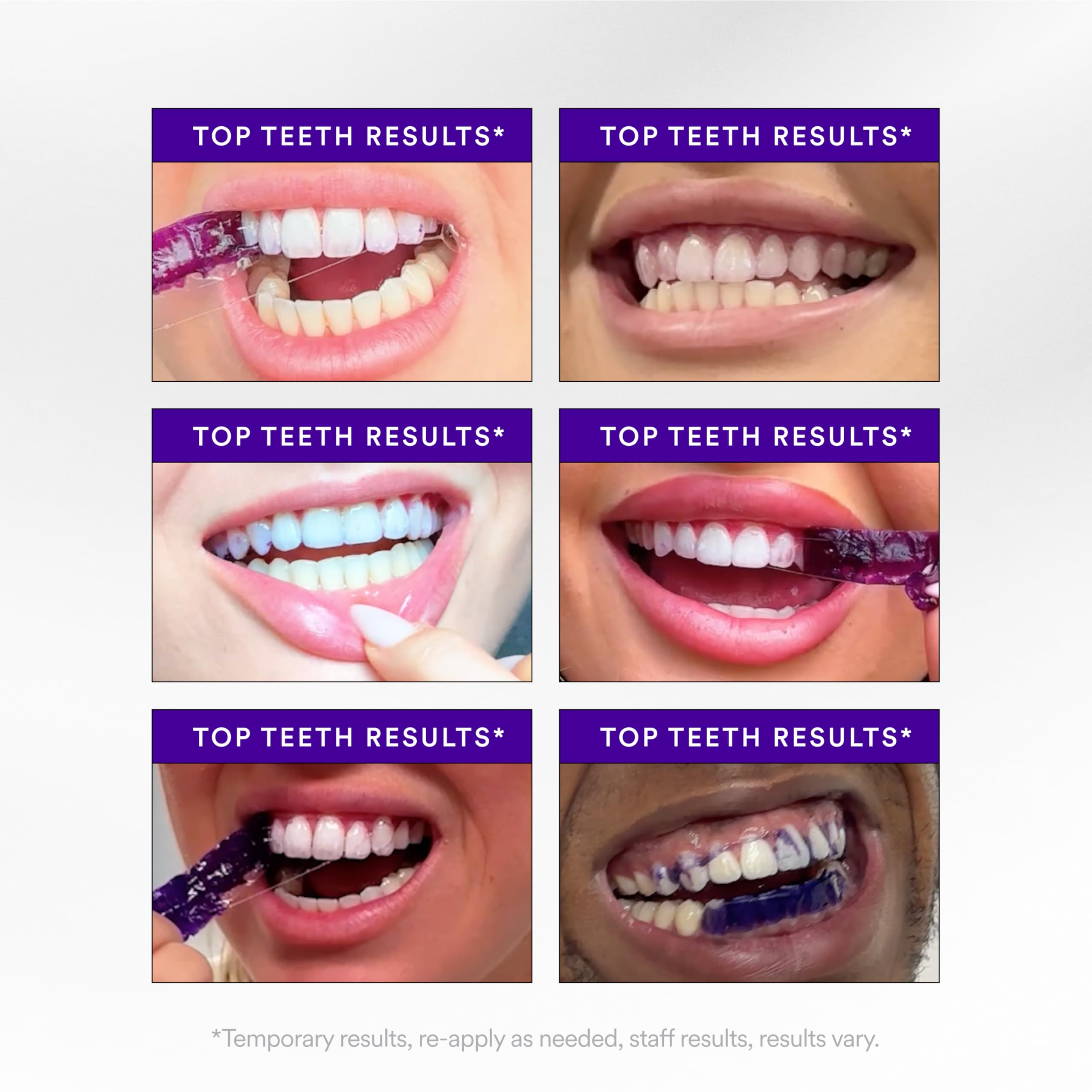 Hismile V34 Teeth Whitening Strips | Colour Correction

