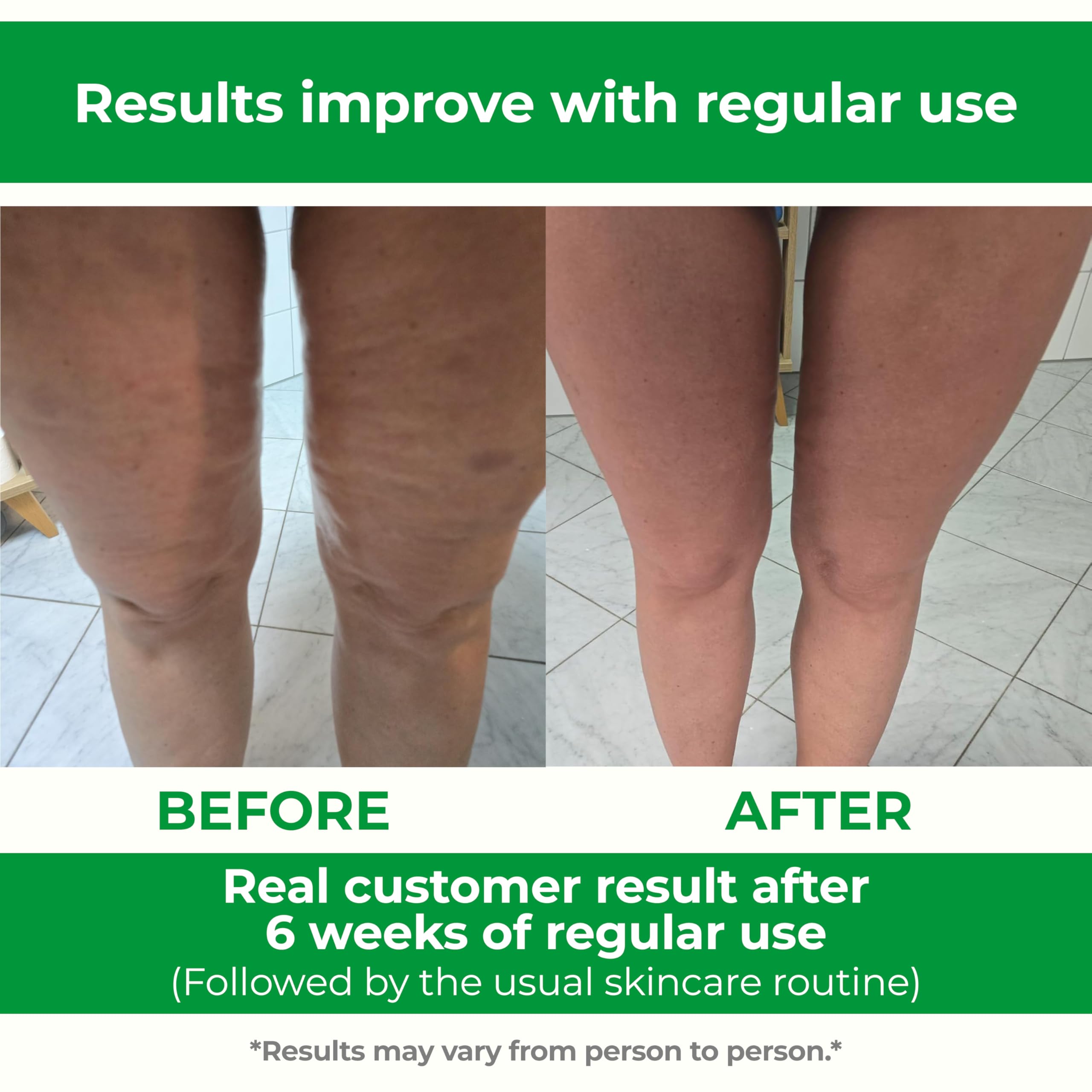TESMED Cellulite Manual Massager - Patented Roller System

