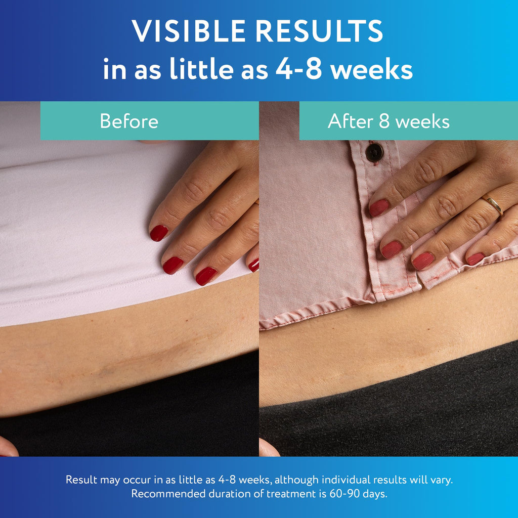 ScarAway Advanced Clear Silicone Scar Sheets | Medical Grade

