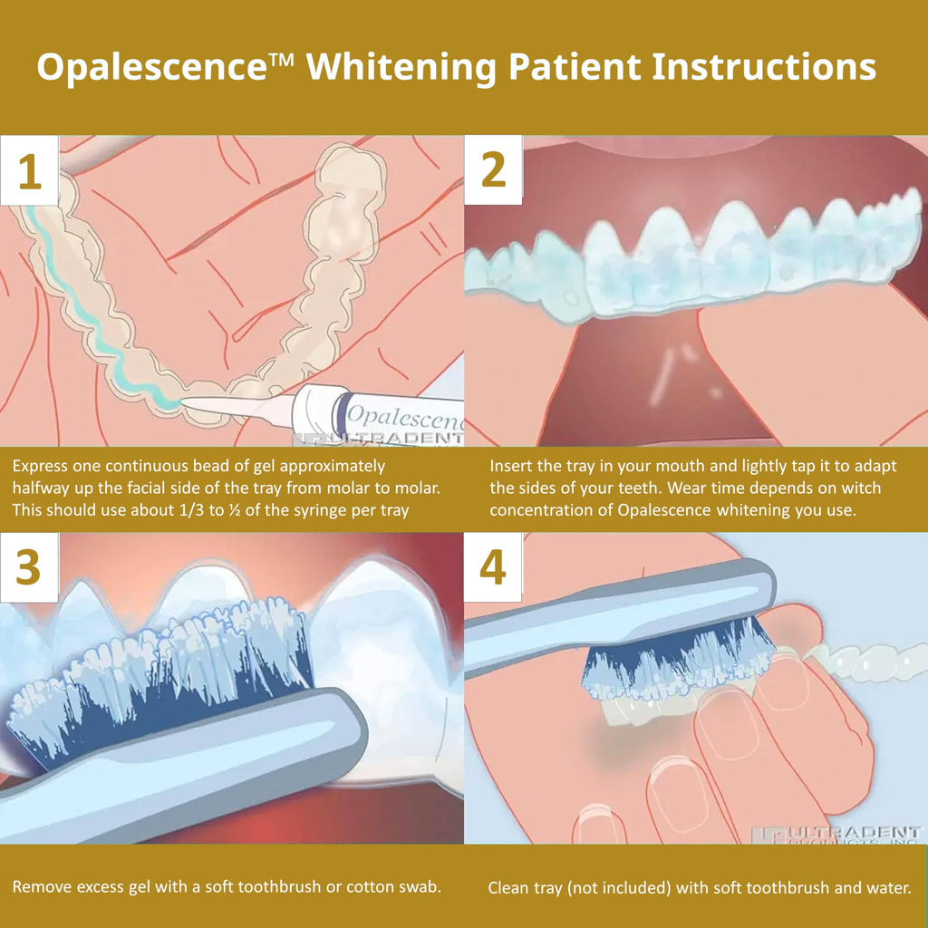 Opalescence Teeth Whitening Gel Refill Kit - Ultradent

