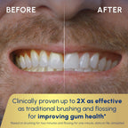 Waterpik Sonic-Fusion Toothbrush with Water Flosser

