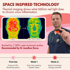 NoMore Red Light Therapy for Nose LED Nasal Device

