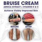 SKINTENSIVE Arnica Bruise Cream for Thin Skin | Non-Greasy

