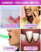 CAREDO Gum Disease Toothpaste for Periodontal Health

