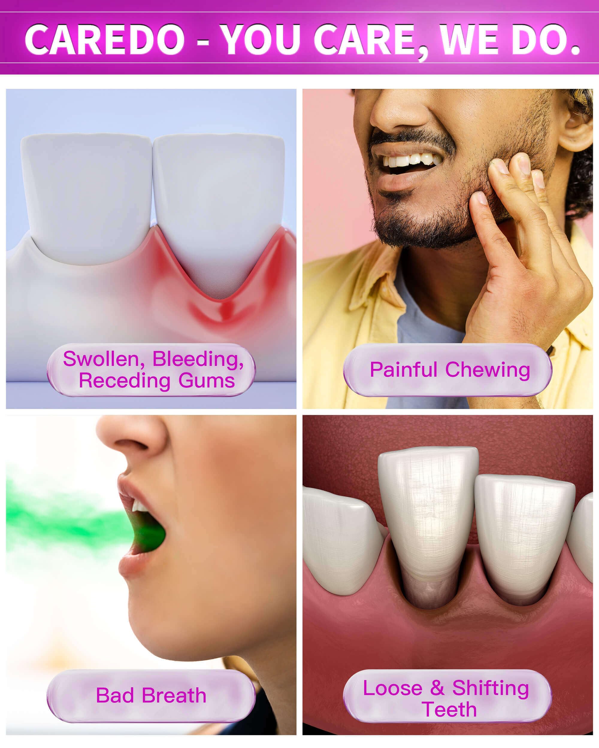 CAREDO Gum Disease Toothpaste for Periodontal Health

