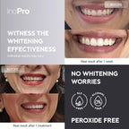 InoPro Natural Teeth Whitening Strips – Peroxide-Free

