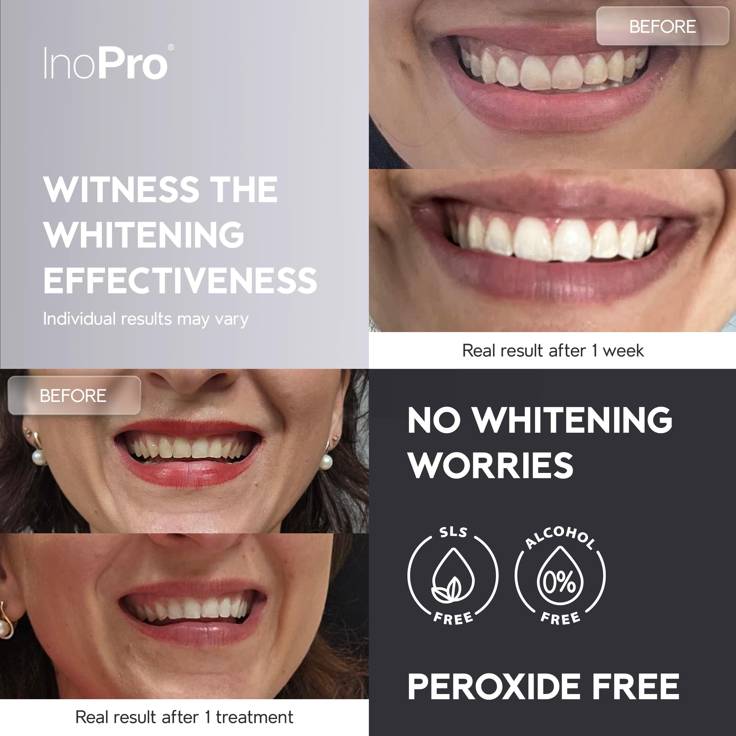 InoPro Natural Teeth Whitening Strips – Peroxide-Free

