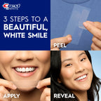 Crest 3D Whitestrips Professional Effects Teeth Whitening Kit 44 Strips

