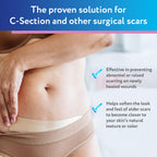 ScarAway Silicone Scar Strips - Advanced for C-Section

