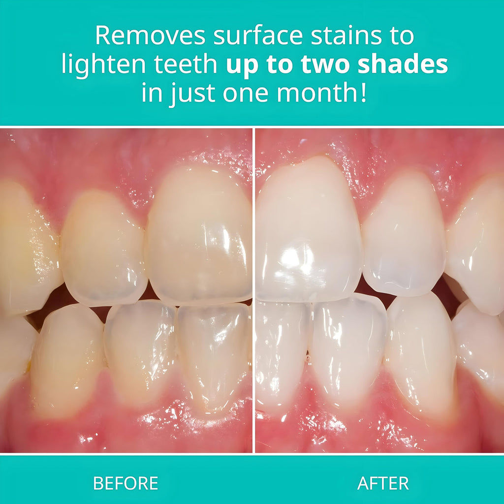 Opalescence Teeth Whitening Toothpaste by Ultradent


