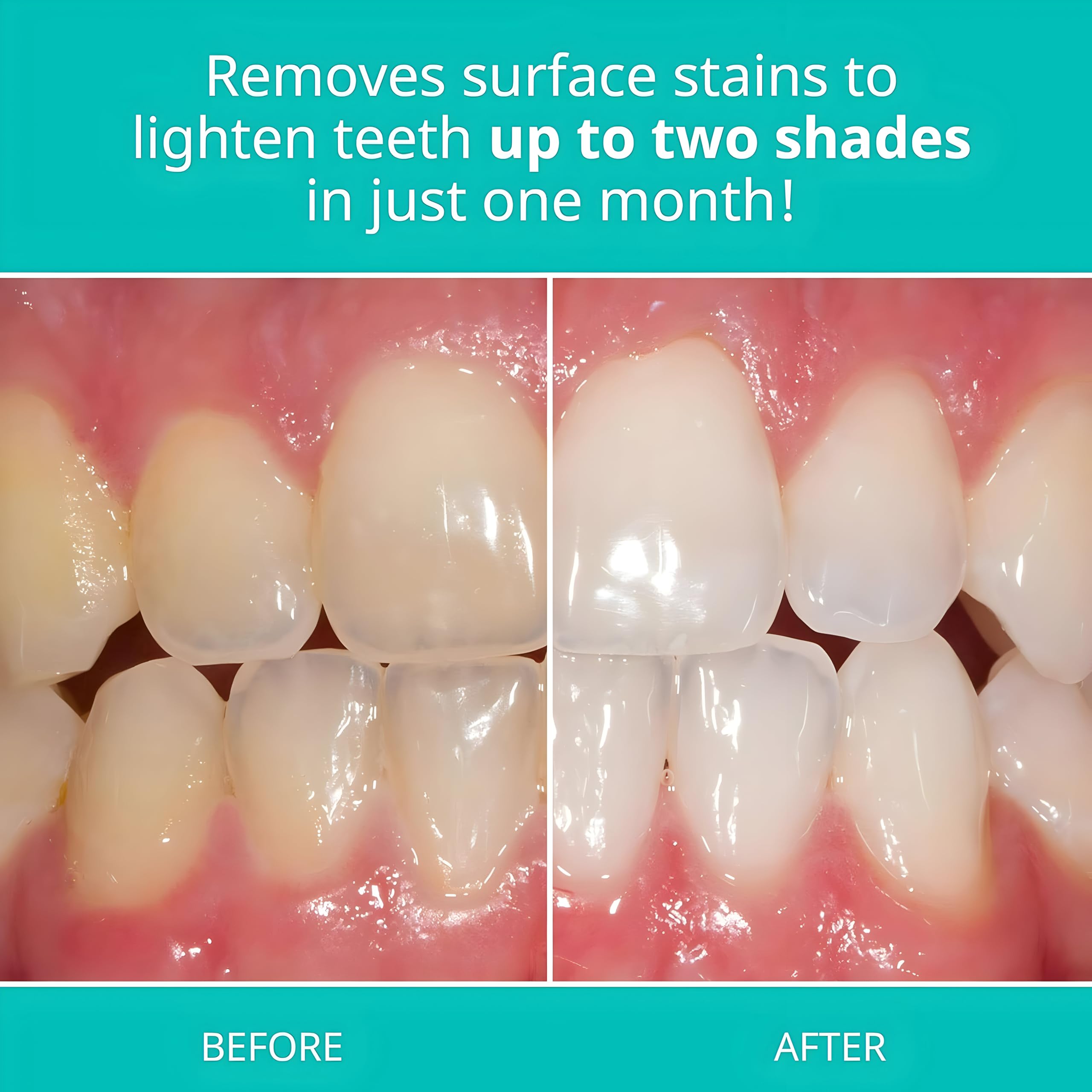 Opalescence Teeth Whitening Toothpaste by Ultradent

