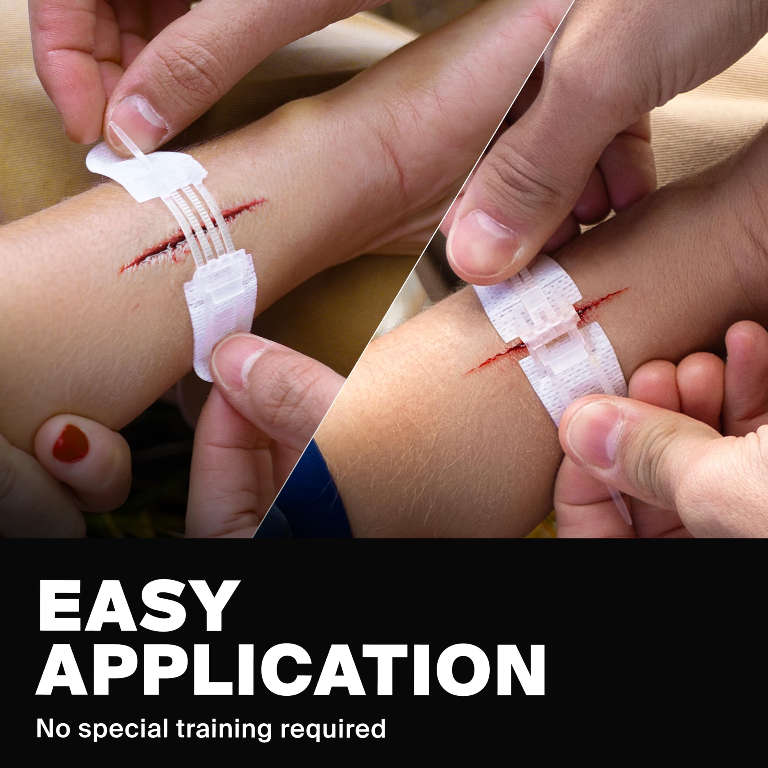 SurviveX Zip Stitch Wound Closure Strips - Non-Invasive

