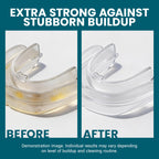 M3 Retainer and Denture Cleansers for Removable Appliances

