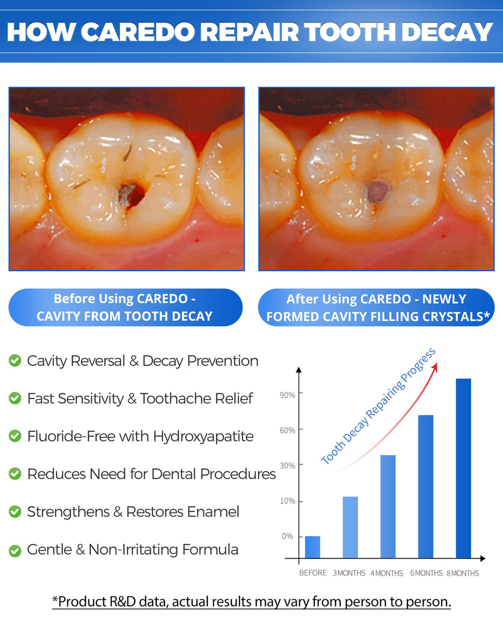 CAREDO Cavity Reversal Hydroxyapatite Toothpaste


