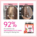 Biotin Gummies for Hair, Skin & Nails - 5,000 mcg Vegan

