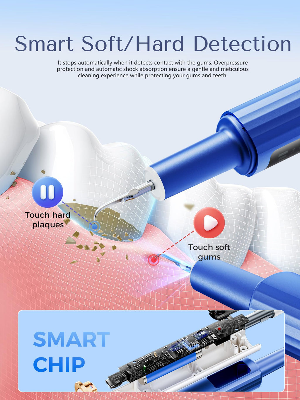 Ultrasonic Plaque Remover for Teeth with Gum Protection

