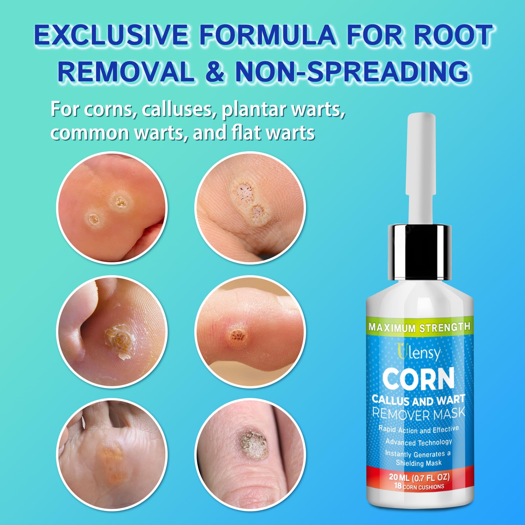 Ulensy Corn Remover Liquid for Feet with Salicylic Acid

