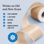 NUVADERMIS Silicone Scar Sheets for Surgical Scars

