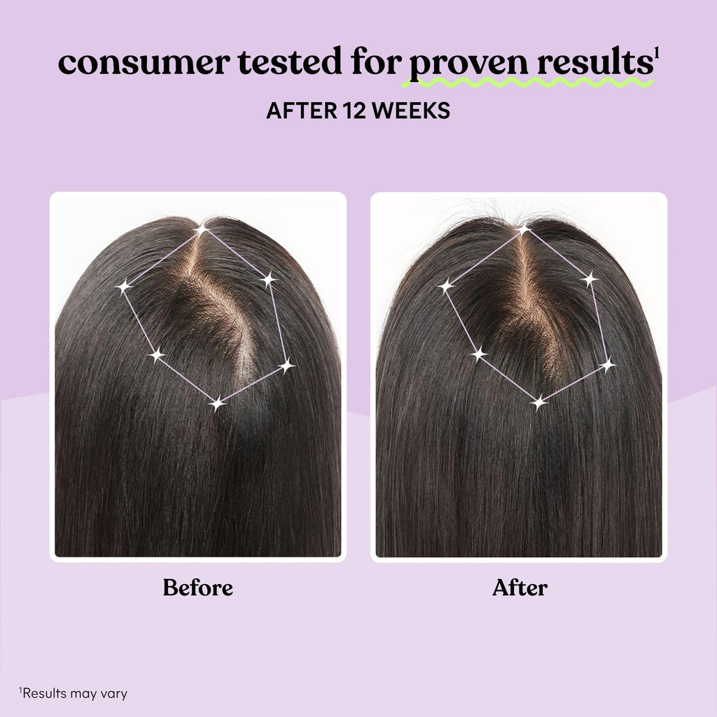 Hair Growth Capsules by Lemme Grow | Keratin Complex

