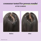Hair Growth Capsules by Lemme Grow | Keratin Complex

