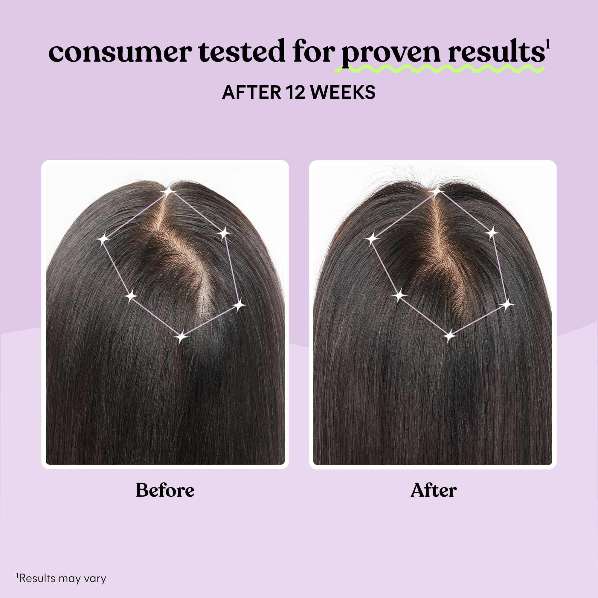 Hair Growth Capsules by Lemme Grow | Keratin Complex

