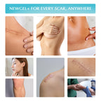 MyNewGel Silicone Scar Gel with Vitamin E - Scar Care

