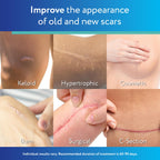 ScarAway Advanced Clear Silicone Scar Sheets | Medical Grade

