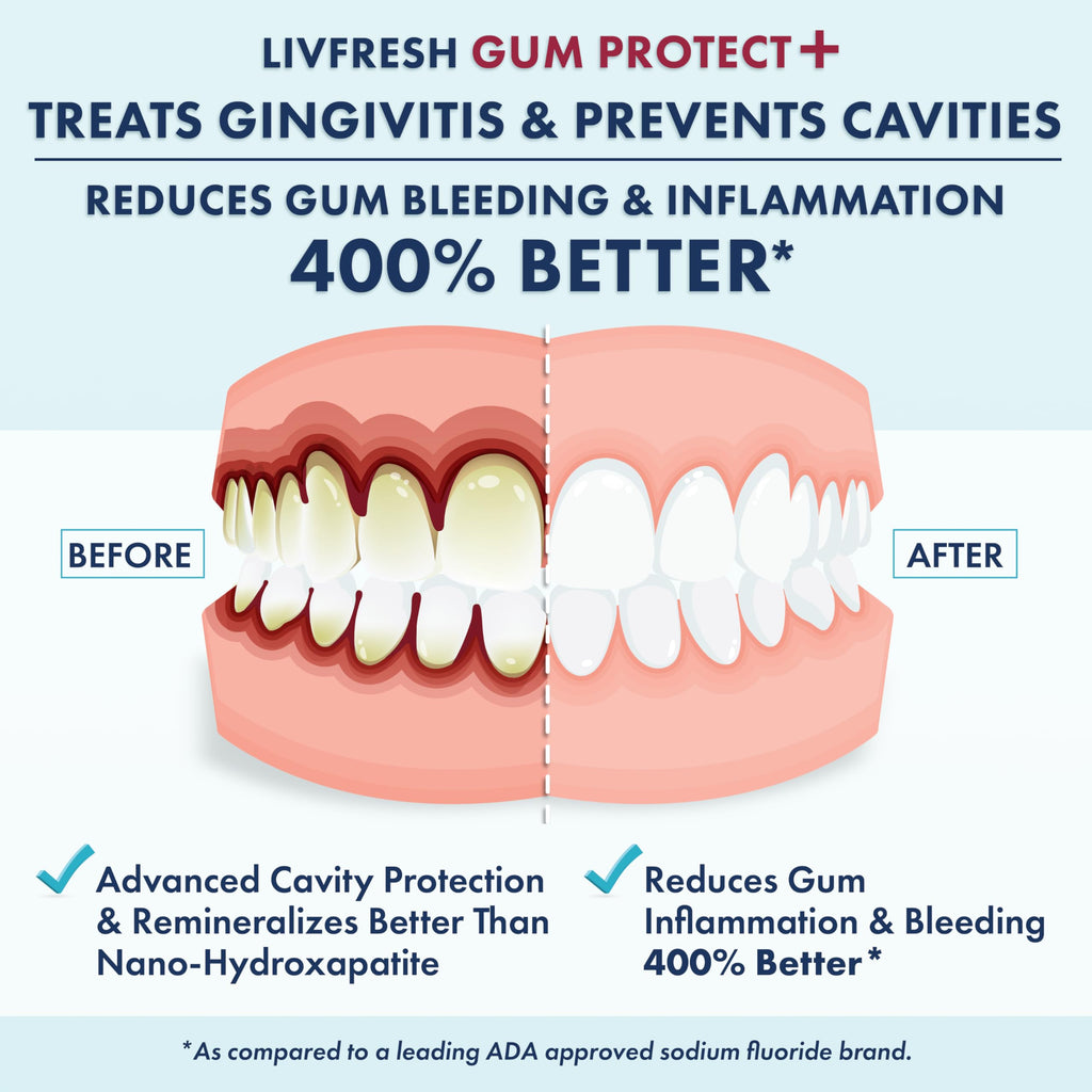LIVFRESH Gum Protect Toothpaste Gel for Gingivitis


