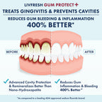 LIVFRESH Gum Protect Toothpaste Gel for Gingivitis

