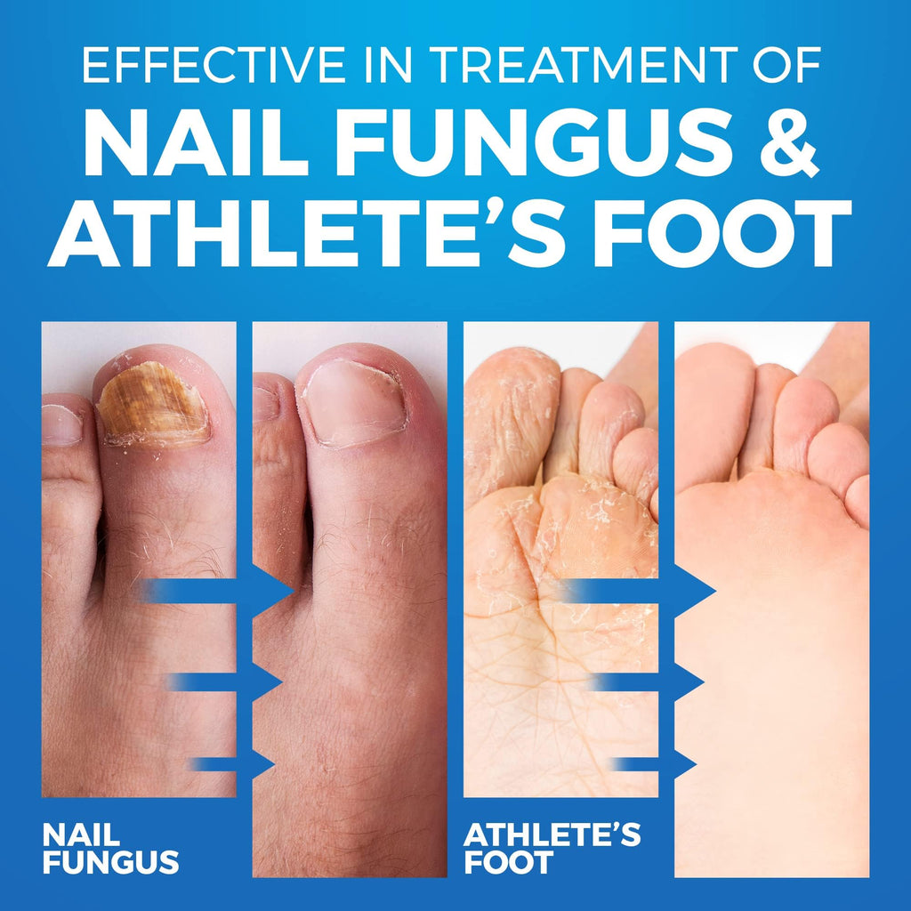 Toenail Fungus Treatment Extra Strength Foot Deodorizer

