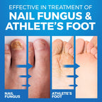 Toenail Fungus Treatment Extra Strength Foot Deodorizer

