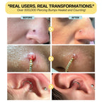 Base Laboratories Piercing Keloid & Bump Care Set

