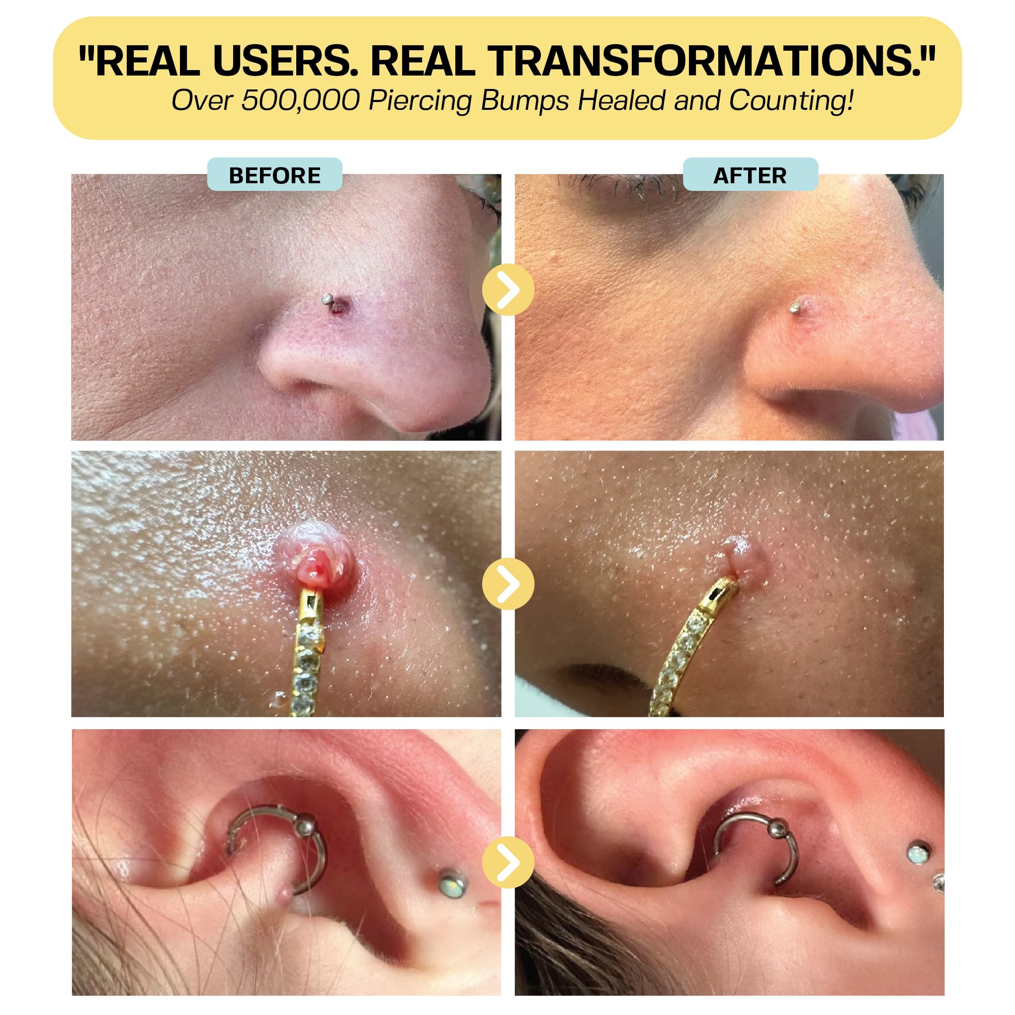 Base Laboratories Piercing Keloid & Bump Care Set

