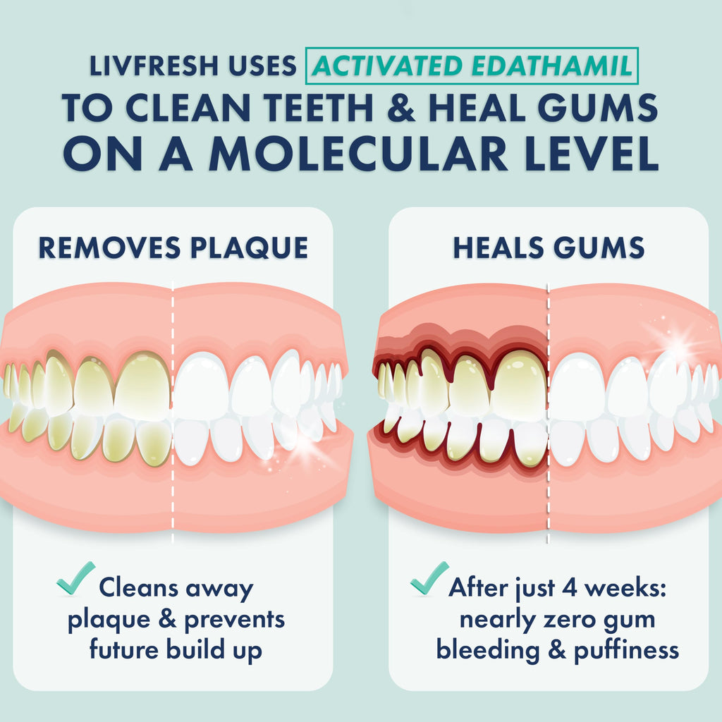 LIVFRESH Toothpaste Gel – SLS-Free Dental Gel

