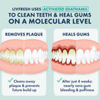 LIVFRESH Toothpaste Gel – SLS-Free Dental Gel

