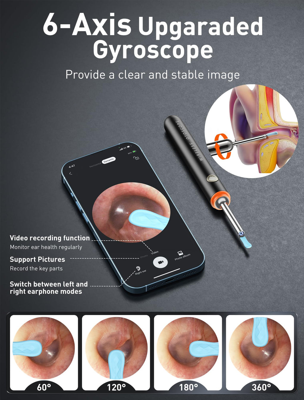 Yorsfun 3-in-1 Ear Wax Removal Kit with Ear Camera


