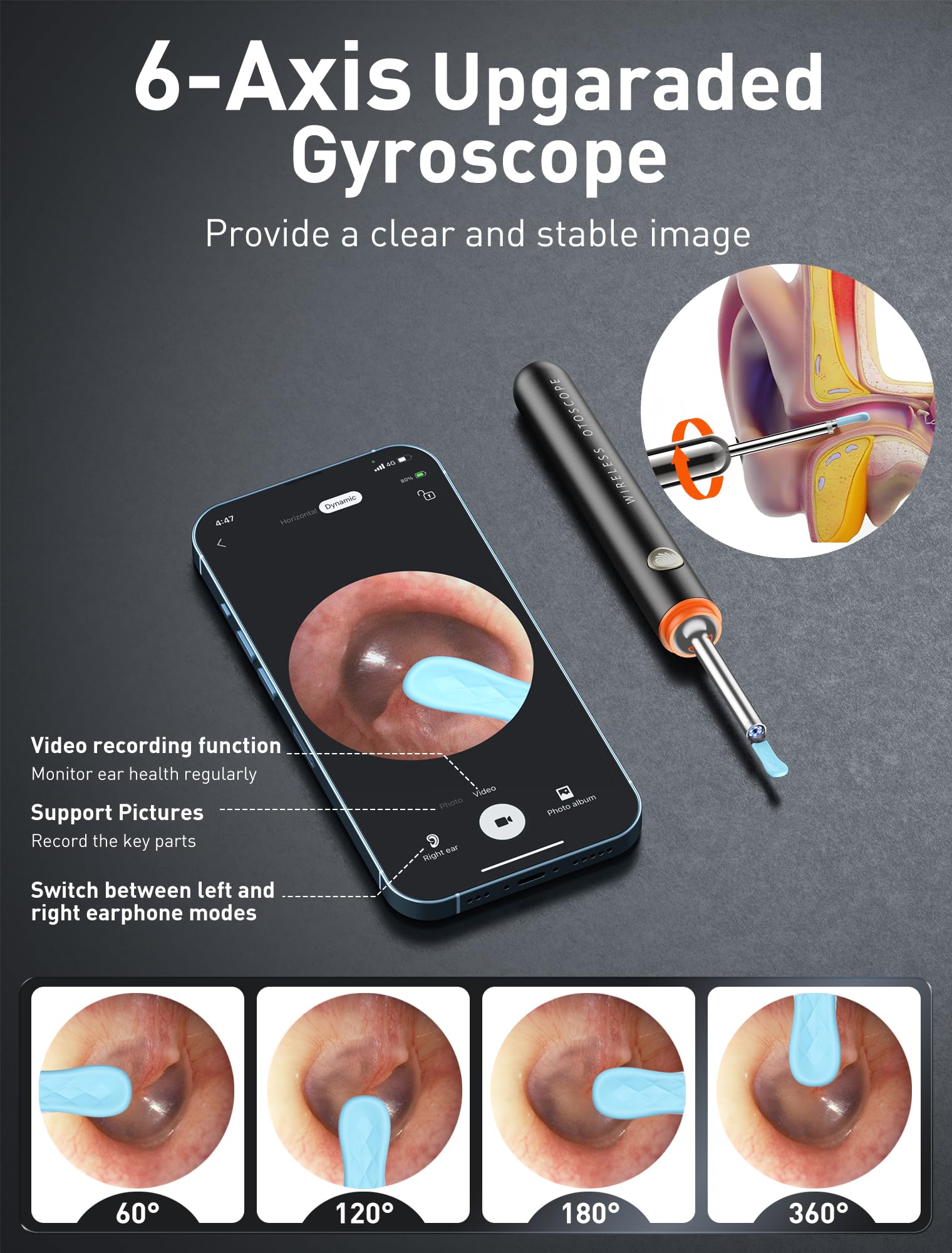 Yorsfun 3-in-1 Ear Wax Removal Kit with Ear Camera

