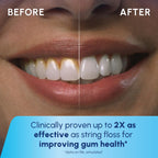 Waterpik Cordless Express Flosser WF-02 | Battery Operated

