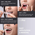 InoPro Natural Teeth Whitening Strips – Peroxide-Free

