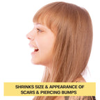 Base Laboratories Piercing Keloid & Bump Care Set

