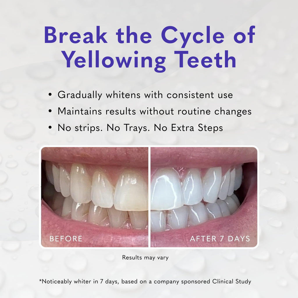 Smileactives Pro Teeth Whitening Gel for Toothpaste

