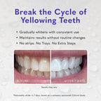 Smileactives Pro Teeth Whitening Gel for Toothpaste

