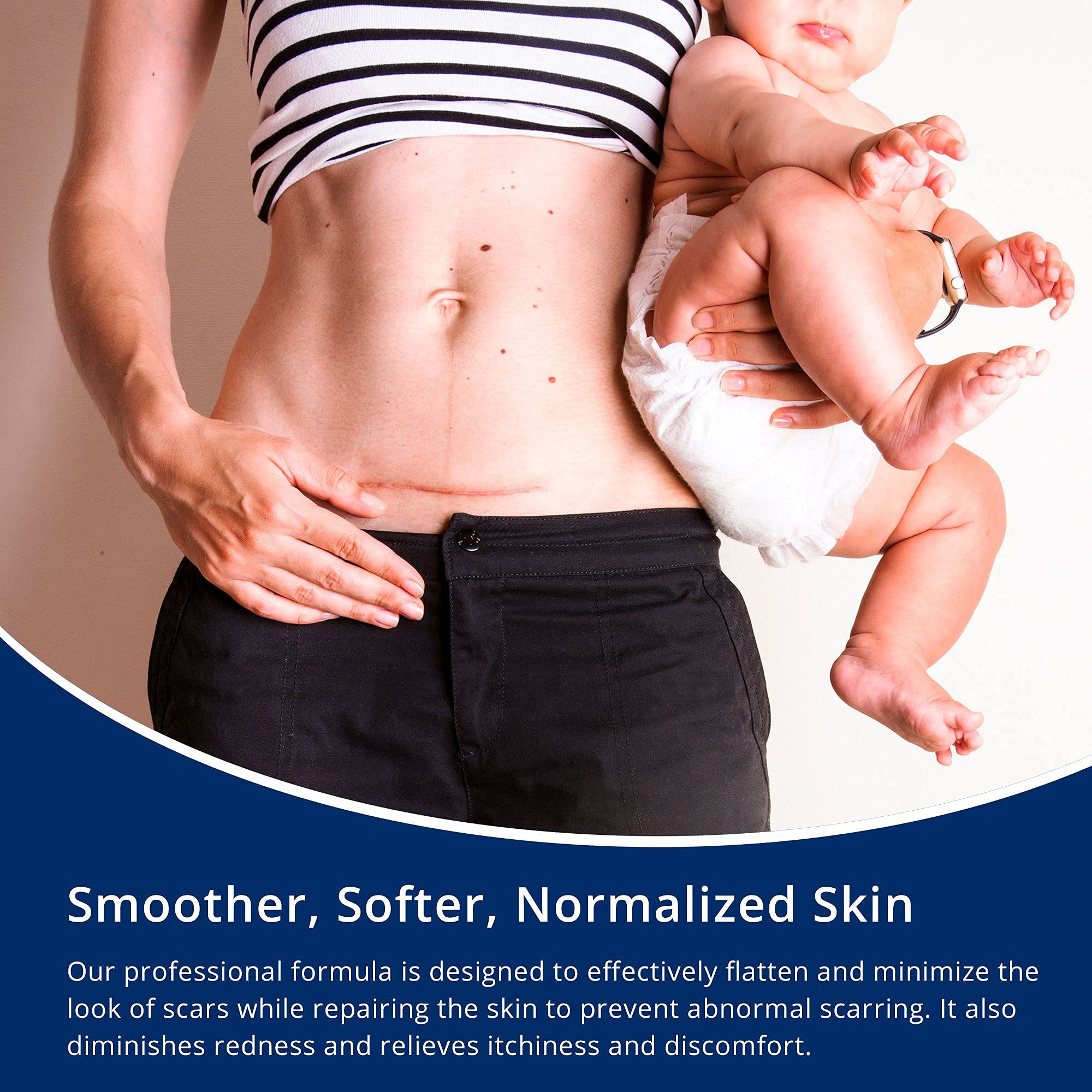 Silicone Scar Gel by Murasaki Beauty for Surgical Scars

