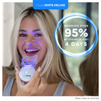 Teeth Whitening Kit by PurelyWHITE Deluxe

