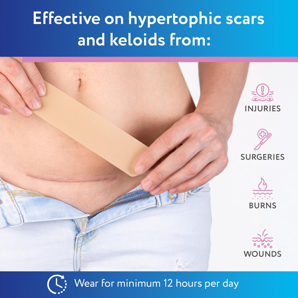 ScarAway Silicone Scar Strips - Advanced for C-Section

