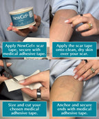 Silicone Scar Tape NewGel Plus Medical-Grade 1mm Sheet

