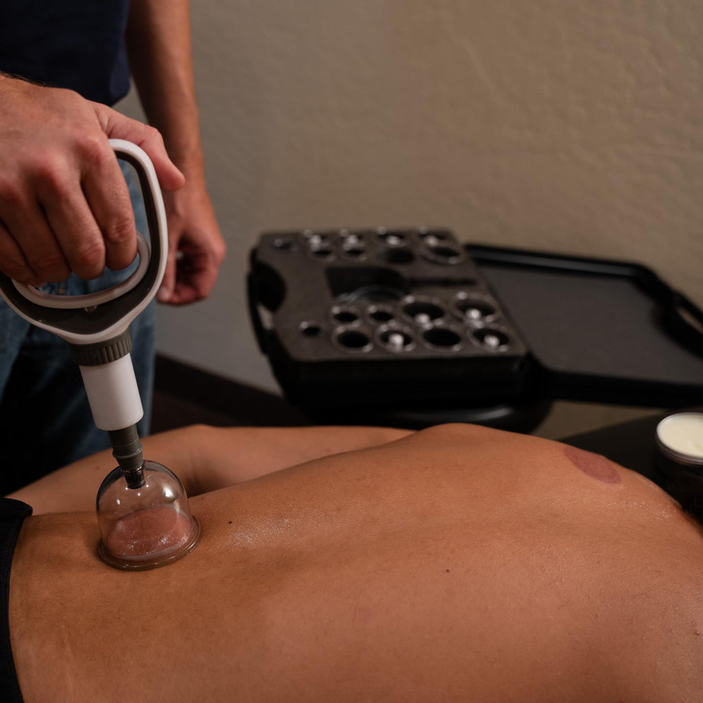 Myofascial Releaser Cupping Therapy Set for Therapists

